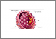 Hepatitis B